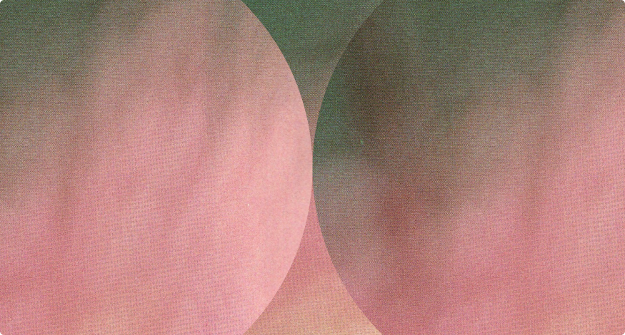 Stripe Reviews, Pricing & Alternatives (February 2026)